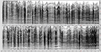 Figure 12. Sonogram of an excerpt from Audio example 31.